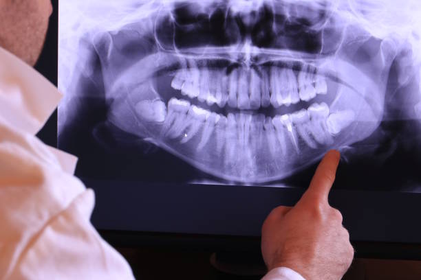 Best Weekend Emergency Dentist in Northampton, PA